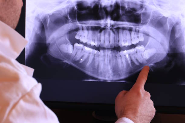 Best Cracked Tooth Emergency Dentist  in Sanford, CO